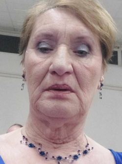 Val�ria, 73 �ves t�rskeres� n�, F�zesabony